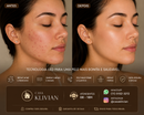 TRATAMENTO FACIAL PREMIUM EM CASA Clareia a Pele, Controla Acne e Reduz Poros e muito mais